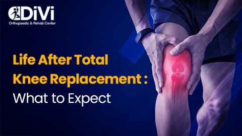 Total Knee Replacement Surgery Recovery: What to Expect