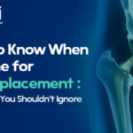 Symptoms You Should Need a Hip Replacement Surgery