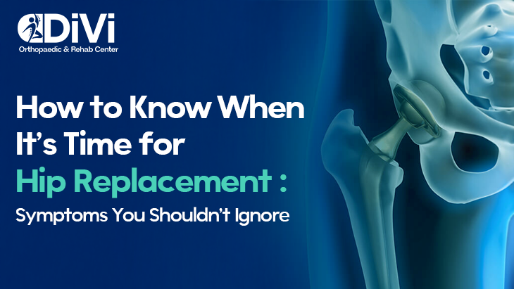 Symptoms You Should Need a Hip Replacement Surgery