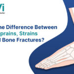 Illustration showing the difference between sprains, strains, and bone fractures in the foot explained by an orthopaedic specialist in andheri