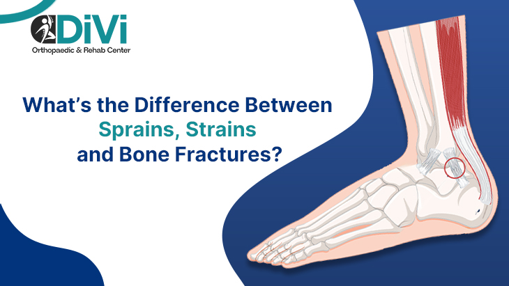 Illustration showing the difference between sprains, strains, and bone fractures in the foot explained by an orthopaedic specialist in andheri