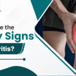 Early signs of arthritis showing knee joint pain and stiffness