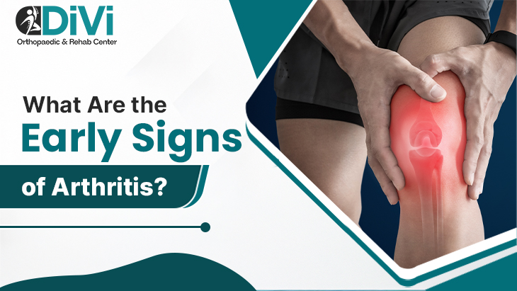 What Are the Early Signs of Arthritis? Early signs of arthritis showing knee joint pain and stiffness