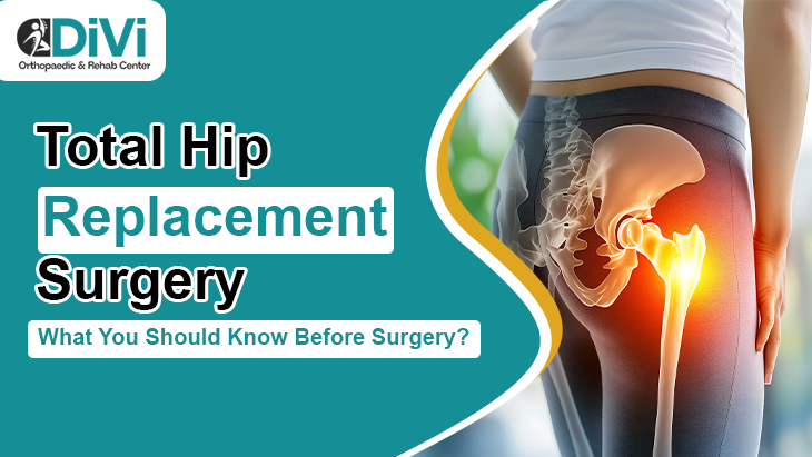 Total Hip Replacement Surgery: What You Should Know Before Surgery?
