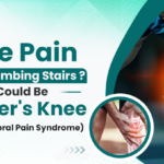 Knee pain while climbing stairs due to Runner's Knee (Patellofemoral Pain Syndrome)