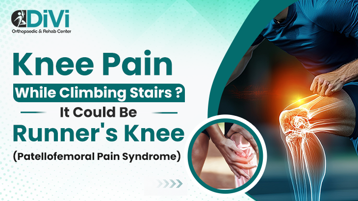Knee Pain While Climbing Stairs – Runner’s Knee Explained Knee pain while climbing stairs due to Runner's Knee (Patellofemoral Pain Syndrome)