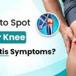 Early knee arthritis symptoms including knee pain and stiffness
