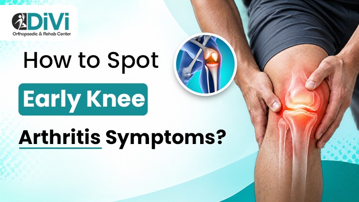 Early Knee Arthritis Symptoms Early knee arthritis symptoms including knee pain and stiffness